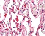 IHC staining of FFPE human lung with ACAP1 antibody at 5ug/ml. HIER: steamed with pH6 citrate buffer, AP-staining.