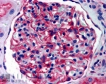 IHC staining of FFPE human kidney with APA antibody at 4ug/ml. HIER: steamed with pH6 citrate buffer, AP-staining.