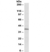 CD38 Antibody human spinal cord cancer lysate WB. Western blot analysis of CD38 expression in human spinal cord cancer lysate using CD38 antibody at 2 ug/ml. Lane 1: human spinal cord cancer lysate. A band is detected at approximately 35â40 kDa, consistent with the predicted molecular weight of CD38, with slight variation reflecting glycosylation of this cell surface protein. The detection profile supports its role in studies of immune cell interaction and communication within tumor-associated environments.