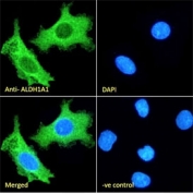ALDH1A1 Antibody HepG2 cell IF/ICC. Immunofluorescent staining of fixed and permeabilized human HepG2 cells with ALDH1A1 antibody (green) at 10ug/ml and DAPI nuclear stain (blue).