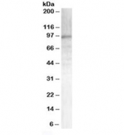 Western blot testing of human brain lysate with Androgen receptor antibody at 0.3ug/ml. Predicted molecular weight ~99 kDa.