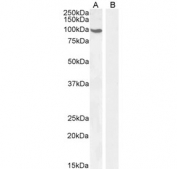 Western blot testing of human A) cerebellum and B) pancreas (negative control) tissue lysate with Androgen receptor antibody at 0.3ug/ml. Predicted molecular weight ~99 kDa.
