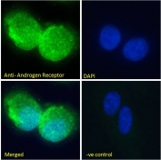 IF/ICC staining of fixed and permeabilized human U-2 OS cells with Androgen receptor antibody (green) at 10ug/ml and DAPI nuclear stain (blue).
