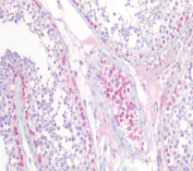 IHC staining of FFPE human testis tissue with UCHL1 antibody at 5ug/ml. Required HIER: steamed antigen retrieval with pH6 citrate buffer; AP-staining.