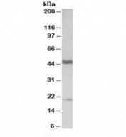 GATA3 Antibody Tonsil WB. Western blot testing of human tonsil lysate with GATA3 antibody at 0.3ug/ml. Predicted molecular weight ~50 kDa. Both bands are blocked by the immunizing peptide.