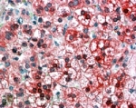 AXIN1 Antibody Adrenal Cortex IHC. Immunohistochemistry testing of FFPE human adrenal cortex with AXIN1 antibody at 4ug/ml. HIER: steamed with pH6 citrate buffer, AP-staining.