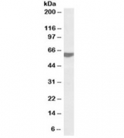 Western blot testing of human tonsil lysate with RAP1 antibody at 0.2ug/ml. Predicted molecular weight ~44kDa but routinely observed at 55~60kDa
