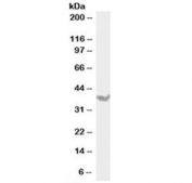 DAZL Antibody Rat Testis WB. Western blot analysis of rat testis lysate using DAZL Antibody / Germ Cell Marker Antibody demonstrates a distinct immunoreactive band at approximately 32-35 kDa, consistent with expression of DAZL. DAZL is a conserved RNA-binding protein that plays a critical role in germline specification, germ cell differentiation, and reproductive development through regulation of mRNA translation in developing germ cells. Expression of DAZL is closely associated with spermatogenic cell populations and is widely utilized as a marker of germline lineage commitment and fertility-associated pathways. The observed band migrates near the predicted molecular weight of approximately 32 kDa and is consistent with endogenous DAZL expression in rat testicular tissue. Antibody concentration: 1 ug/ml. Predicted molecular weight: approximately 32 kDa. Observed molecular weight: approximately 32-35 kDa.