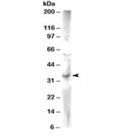 Western blot testing of human heart lysate with FRAT2 antibody at 2ug/ml. Predicted molecular weight ~25kDa.