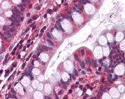 IHC testing of FFPE human small intestine tissue with Serotonin Receptor 3A antibody at 3.75ug/ml. Required HIER: steamed antigen retrieval with pH6 citrate buffer; AP-staining.