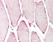 IHC testing of FFPE human skeletal muscle tissue with MURF3 antibody at 3.75ug/ml. Required HIER: steamed antigen retrieval with pH6 citrate buffer; AP-staining.