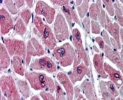IHC staining of FFPE human heart with PAR6 antibody at 5ug/ml. HIER: steamed with pH6 citrate buffer, AP-staining. Speckled staining on myocardial fibers is seen.