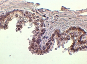 FOXA1 Antibody Prostate IHC. Immunohistochemistry staining of FFPE human prostate tissue with FOXA1 antibody at 2ug/ml. HIER: steamed with pH6 citrate buffer, HRP-staining.