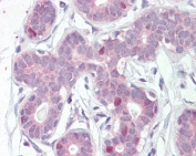 FOXA1 Antibody Breast IHC. Immunohistochemistry staining of FFPE human breast tissue with FOXA1 antibody at 5ug/ml. HIER: steamed with pH6 citrate buffer, AP-staining.