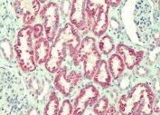 IHC testing of FFPE human kidney tissue with ANTXR2 antibody at 2.5ug/ml. Required HIER: steamed antigen retrieval with pH6 citrate buffer; AP-staining.