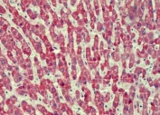 IHC testing of FFPE human liver tissue with ANTXR2 antibody at 2.5ug/ml. Required HIER: steamed antigen retrieval with pH6 citrate buffer; AP-staining.