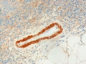 IHC testing of FFPE human lymph node with USP20 antibody at 3ug/ml. Microwaved antigen retrieval with Tris/EDTA buffer pH9, HRP-staining.
