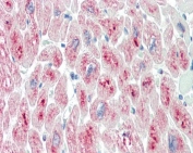 IHC testing of FFPE human heart tissue with TRIM55 antibody at 10ug/ml. HIER: steamed antigen retrieval with pH6 citrate buffer; AP-staining.