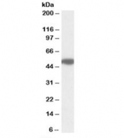 Western blot testing of human pancreas lysate with MON1A antibody at 1ug/ml. Predicted molecular weight: ~55kDa.