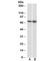 LCP1 Antibody / L-Plastin Antibody Daudi and U937 WB. Western blot analysis of LCP1 expression was performed using anti-LCP1 antibody in Daudi and U937 cell lysates. LCP1, also known as L-Plastin or Lymphocyte Cytosolic Protein 1, is a calcium-regulated actin-bundling protein predominantly expressed in hematopoietic cells and involved in leukocyte activation, migration, and cytoskeletal remodeling. Lane A: Daudi lysate. Lane B: U937 lysate. A prominent immunoreactive band is detected at approximately 70 kDa in both cell lines, corresponding to the predicted molecular weight of LCP1. Strong expression in B lymphocyte-derived Daudi cells and monocytic U937 cells is consistent with the established role of L-plastin as a marker of hematopoietic lineages and mediator of immune cell function. These results support the utility of LCP1 Antibody / L-Plastin Antibody for studies of inflammation, hematopoiesis, immune cell biology, and cell migration.