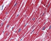 IHC testing of FFPE human heart tissue with FH antibody at 3.75ug/ml. Required HIER: steamed antigen retrieval with pH6 citrate buffer; AP-staining.