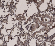 IHC testing of FFPE human lung tissue with GAPDH loading control antibody at 6ug/ml. Required HIER: steamed antigen retrieval with pH6 citrate buffer; HRP-staining.