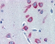 IHC testing of FFPE human cerebral cortex with PCK1 antibody at 2ug/ml. HIER: steamed with pH6 citrate buffer, AP-staining.