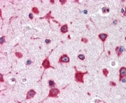 RPL8 Antibody Cerebral Cortex IHC. Immunohistochemistry staining of FFPE human cerebral cortex with RPL8 antibody at 2.5ug/ml. HIER: steamed with pH6 citrate buffer, AP-staining.