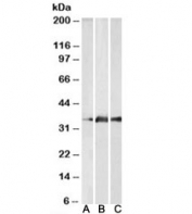 KLK5 Antibody Brain WB. Western blot analysis of A) human cerebellum, B) mouse brain, and C) rat brain lysates using KLK5 Antibody detects bands at approximately 32 kDa, consistent with the predicted molecular weight of Kallikrein 5 / KLK5. This Stratum corneum tryptic enzyme antibody highlights conserved expression of epithelial-associated serine protease signaling machinery across multiple mammalian tissues and supports characterization of kallikrein family-associated proteolytic regulation pathways.