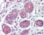 DAPK2 Antibody Human Breast IHC. Immunohistochemistry staining of FFPE human breast tissue using DAPK2 antibody demonstrates predominantly cytoplasmic staining within glandular epithelial cell populations, consistent with expression of Death Associated Protein Kinase 2 (DAPK2). DAPK2 is a calcium/calmodulin-regulated serine/threonine kinase that participates in signaling pathways involved in apoptosis, cellular stress responses, autophagy regulation, and maintenance of tissue homeostasis. The observed staining pattern is consistent with the intracellular localization expected for a signaling kinase and supports the utility of DAPK2 antibody for studies of kinase-mediated regulatory pathways and programmed cell death signaling. HIER: steamed with pH6 citrate buffer. Detection was performed using an AP staining system.