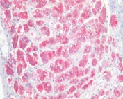 NCAM Antibody Goat Polyclonal. Immunohistochemistry analysis of FFPE human adrenal gland tissue demonstrates strong staining in neuroendocrine-associated cells consistent with expression of Neural cell adhesion molecule 1 (NCAM1), also known as CD56. Red chromogenic signal highlights NCAM1-positive cells within adrenal tissue, reflecting the expected distribution of this cell surface adhesion molecule in neuroendocrine cell populations. Steamed antigen retrieval was performed using pH6 citrate buffer prior to antibody incubation, and staining was visualized using an alkaline phosphatase (AP) detection system.