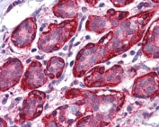 THRA Antibody / Thyroid Hormone Receptor Antibody Human Breast IHC. Immunohistochemical staining of FFPE human breast tissue using THRA Antibody / Thyroid Hormone Receptor Antibody at 3.75 ug/ml. THRA expression is observed predominantly within the nuclei of mammary epithelial cells, consistent with its function as a ligand-activated nuclear receptor that regulates thyroid hormone-responsive gene transcription. Heat-induced epitope retrieval was performed by steaming sections in pH 6 citrate buffer prior to AP-based immunostaining.