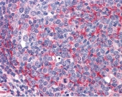THRA Antibody / Thyroid Hormone Receptor Antibody Human Tonsil IHC. Immunohistochemical staining of FFPE human tonsil tissue using THRA Antibody / Thyroid Hormone Receptor Antibody at 3.75 ug/ml. THRA expression is detected predominantly within the nuclei of lymphoid cells, consistent with its role as a ligand-activated nuclear receptor regulating thyroid hormone-responsive gene transcription and immune cell function. Heat-induced epitope retrieval was performed by steaming sections in pH 6 citrate buffer prior to AP-based immunostaining.