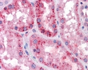 XCT Antibody Kidney Immunohistochemistry. IHC testing of FFPE human kidney tissue with XCT antibody at 3.75ug/ml. HIER: steamed antigen retrieval with pH6 citrate buffer; AP-staining.