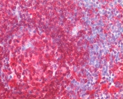 IHC staining of FFPE human spleen tissue with CD74 antibody at 5ug/ml. Required HIER: steamed antigen retrieval with pH6 citrate buffer; AP-staining.