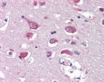 GRIA4 Antibody Human Cortex IHC. Immunohistochemistry was performed on FFPE human cerebral cortex tissue using GRIA4 Antibody at 5 ug/ml. Heat-induced epitope retrieval was carried out in pH 6 citrate buffer, and antibody binding was visualized using an alkaline phosphatase detection system. Distinct cytoplasmic staining is observed in cortical neurons, while the surrounding neuropil exhibits weaker immunoreactivity, consistent with the neuronal expression pattern of GRIA4 as an AMPA receptor subunit. These results demonstrate that this Glutamate Receptor 4 Antibody is suitable for immunohistochemical detection of GRIA4 in formalin-fixed, paraffin-embedded human brain tissue.