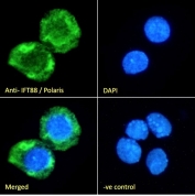 Immunofluorescent staining of fixed and permeabilized human HepG2 cells with ITF88 antibody (green) at 10ug/ml and DAPI nuclear stain (blue).