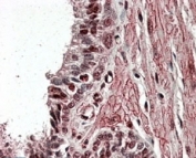 IHC testing of FFPE human prostate with ZNF217 antibody at 4ug/ml. HIER: steamed with pH6 citrate buffer, AP-staining. Nuclear staning in select secretory cells is seen.