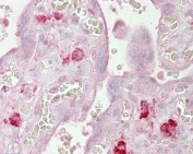 IHC testing of FFPE human placental tissue with AGO1 antibody at 2.5ug/ml. Required HIER: steamed antigen retrieval with pH6 citrate buffer; AP-staining.
