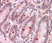 IHC testing of FFPE human small intestine with GNAT3 antibody at 4ug/ml. HIER: steamed with pH6 citrate buffer, AP-staining. Staining of endocrine cells amongst the enterocytes is seen.