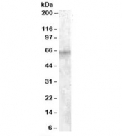 IMP2 Antibody HepG2 Cell WB. Western blot testing of human HepG2 cell lysate with IMP2 / IGF2BP2 antibody at 1 ug/ml. A distinct immunoreactive band is detected at approximately 66 kDa, consistent with the predicted molecular weight of IMP2 (IGF2BP2). The results demonstrate specific detection of this insulin-like growth factor mRNA binding protein, an RNA-binding protein that regulates messenger RNA stability, localization, translation, and m6A-dependent post-transcriptional gene expression.