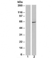 IMP2 Antibody HEK293 Overexpression WB. Western blot testing of HEK293 whole cell lysates transiently transfected with an IMP2 / IGF2BP2 expression construct and probed with IMP2 / IGF2BP2 antibody. Lane 1: Mock-transfected HEK293 cells (negative control). Lane 2: HEK293 cells overexpressing IMP2 / IGF2BP2. A strong immunoreactive band is detected at approximately 66 kDa exclusively in the overexpression lysate, consistent with the predicted molecular weight of IMP2 (IGF2BP2). These results confirm specific recognition of recombinant IMP2, supporting the antibody's suitability for western blot analysis.