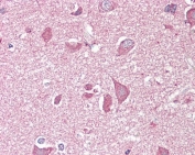 IHC testing of FFPE human cortex (brain) tissue with NCAM2 antibody at 3.75ug/ml. Required HIER: steamed antigen retrieval with pH6 citrate buffer; AP-staining.