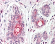 IHC testing of FFPE human breast tissue with MRP8 antibody at 3.75ug/ml. Required HIER: steamed antigen retrieval with pH6 citrate buffer; AP-staining.