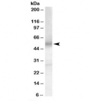 Western blot testing of human testis lysate with EP4 antibody at 0.1ug/ml. Predicted molecular weight: ~53 kDa.