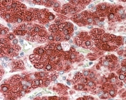 IHC staining of FFPE human adrenal gland with CYP17A1 antibody at 4ug/ml. HIER: steamed with pH6 citrate buffer, AP-staining.
