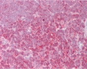 IHC testing of FFPE human thymus tissue with REL antibody at 2.5ug/ml. Required HIER: steamed antigen retrieval with pH6 citrate buffer; AP-staining.