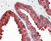 ACPP Antibody Prostate IHC. Immunohistochemistry staining of FFPE human prostate with ACPP antibody at 4ug/ml. HIER: steamed with pH6 citrate buffer, AP-staining.