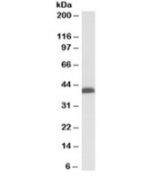 BMI1 Antibody K562 Cell WB. Western blot testing of K562 nuclear lysate with BMI1 antibody at 0.03ug/ml. Predicted molecular weight: 37-43 kDa.