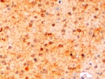 IBA1 Antibody Mouse Brain Immunohistochemistry. IHC staining of FFPE mouse brain with IBA1 antibody at 2ug/ml. HIER: steamed with pH6 citrate buffer, HRP-staining.